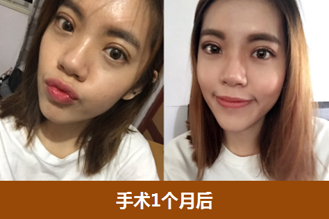 图片 3.png