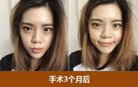 图片 4.png
